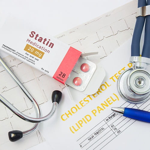 statin medication